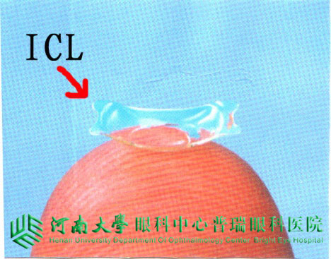 ICL植入术，高度近视患者的福音