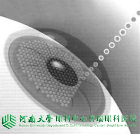 近视度数不同，手术方式怎么选