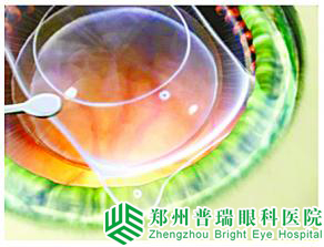 怎样选择适合自己的手术方式