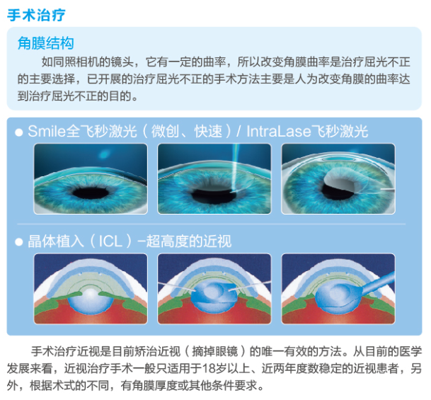 【图文说】如何安心矫正近视