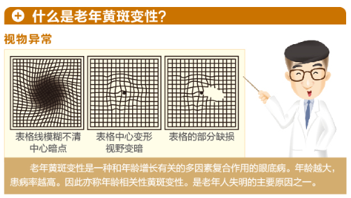 【看图解】老年黄斑变性是怎么回事