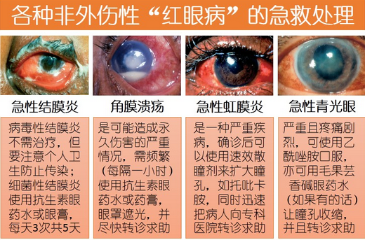 【看图解】一张图带您了解红眼病