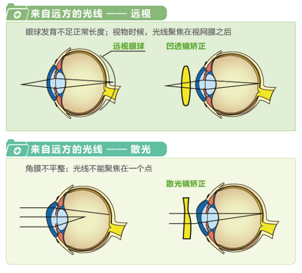 【看图解】一张图教你看懂近视、远视和散光