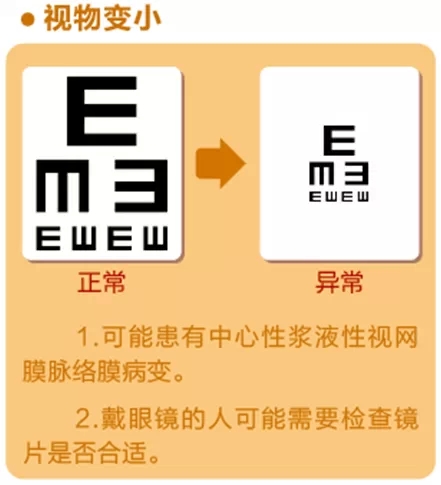 【看图解】视物变形变异常怎么回事